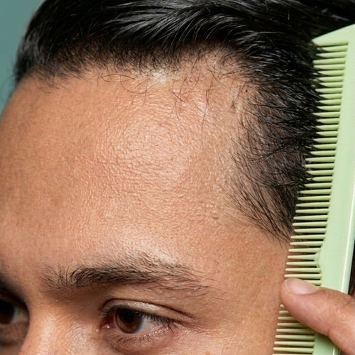 Shedding or Thinning? How to Tell the Difference